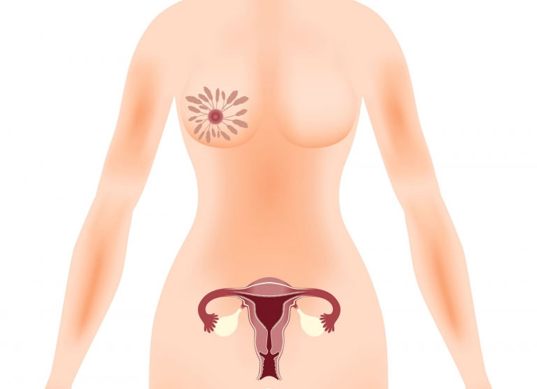 кок при мастопатии и эндометриозе